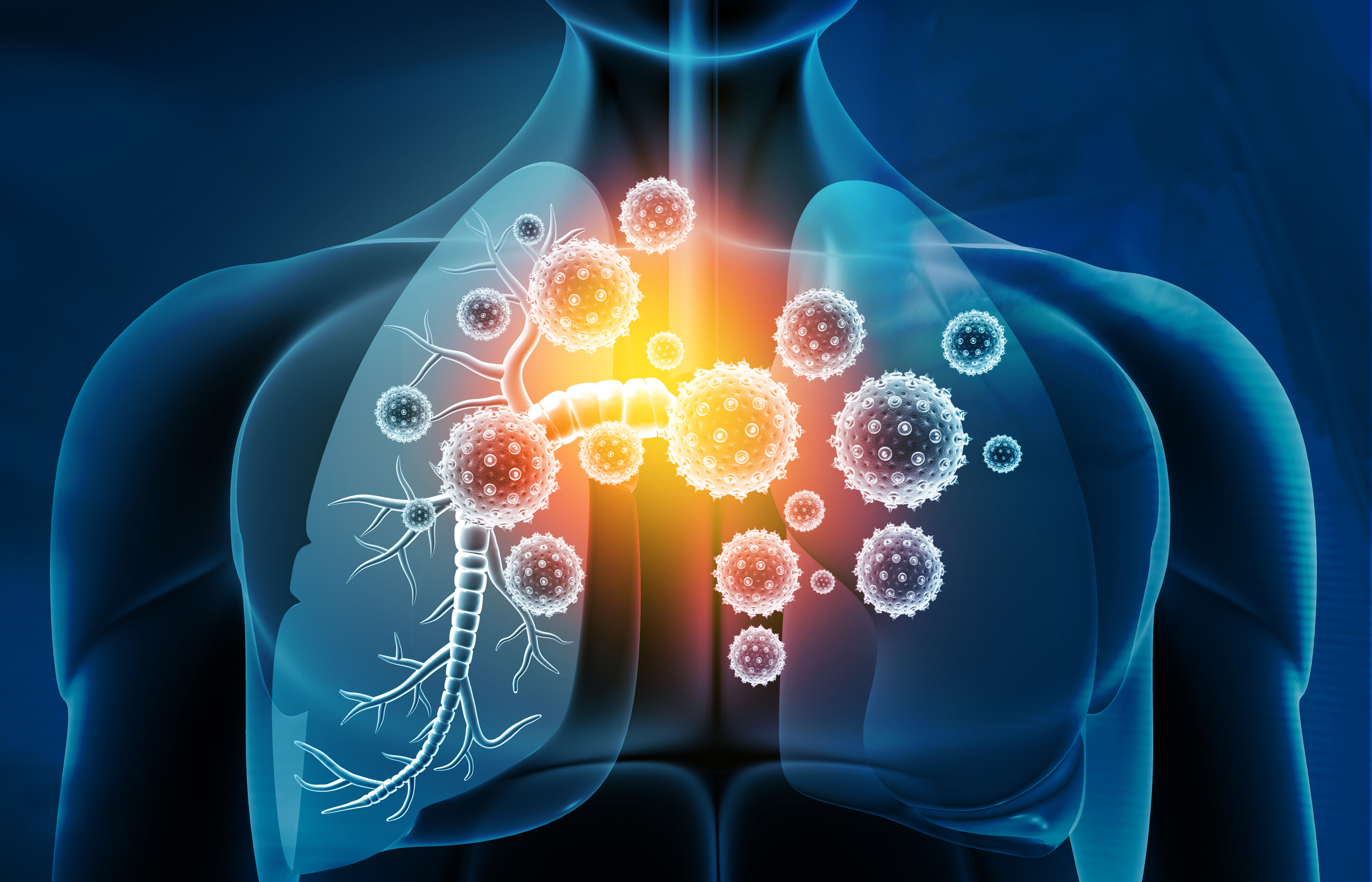 Infections Respiratoires