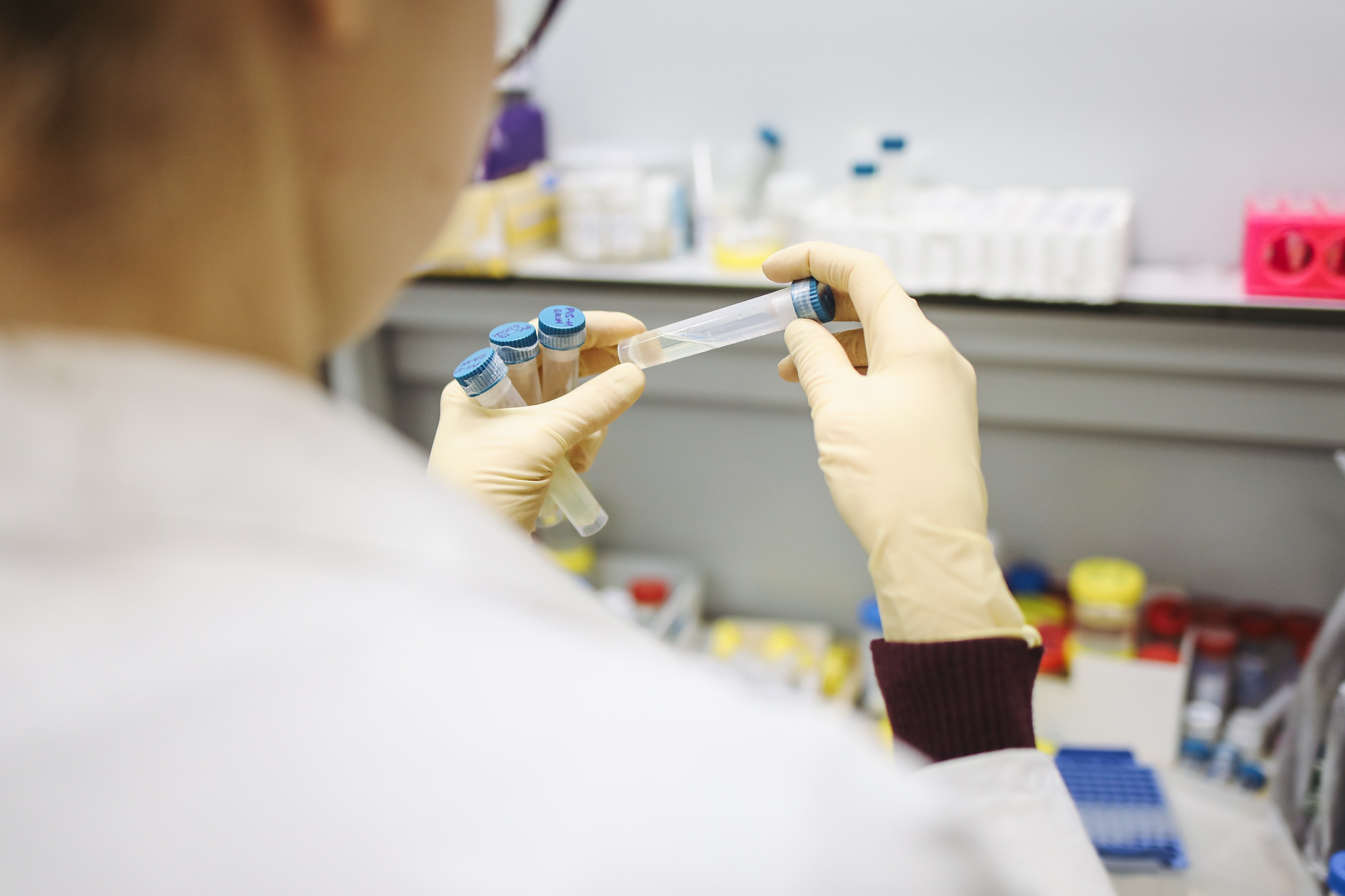 Tests Covid-19 : RT-PCR, antigénique, sérologique, comment ça marche ? -  RespiFIL - Filière de santé des maladies respiratoires rares